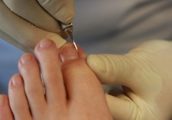 PEDICURE PODOLOGUE