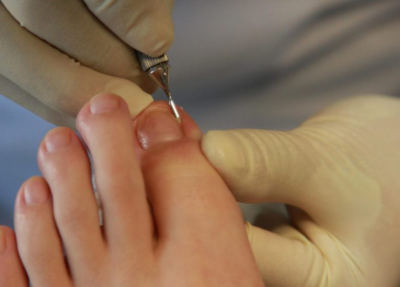 PEDICURE PODOLOGUE